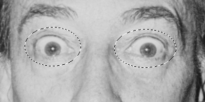 Fig11 Ex2 09 CS6.png