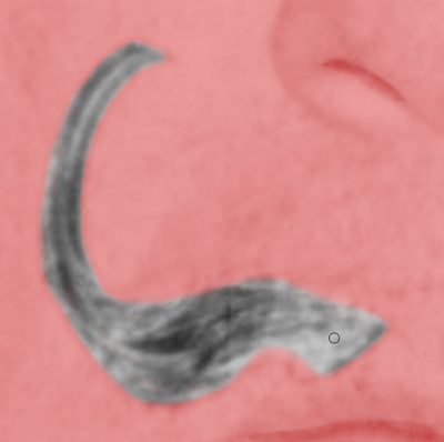 Fig11 Ex1 04a CC2018.png