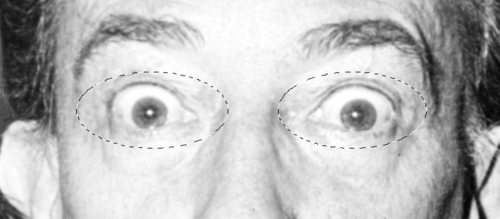 Fig11 Ex2 10 CC2018.png